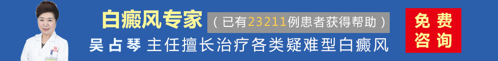 郑州西京白癜风医院